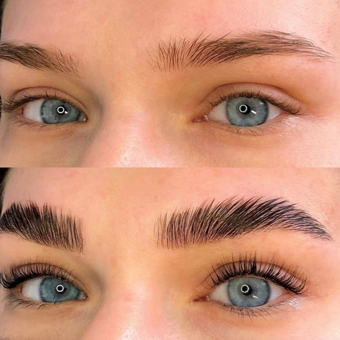 Free Brow Lift Live Training